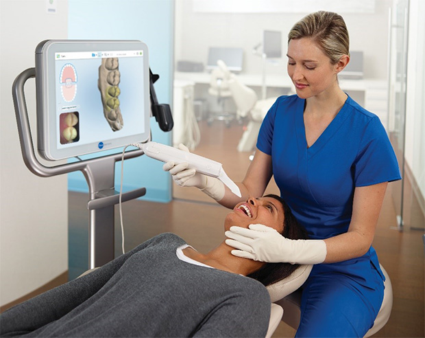 dental scanner for impressions