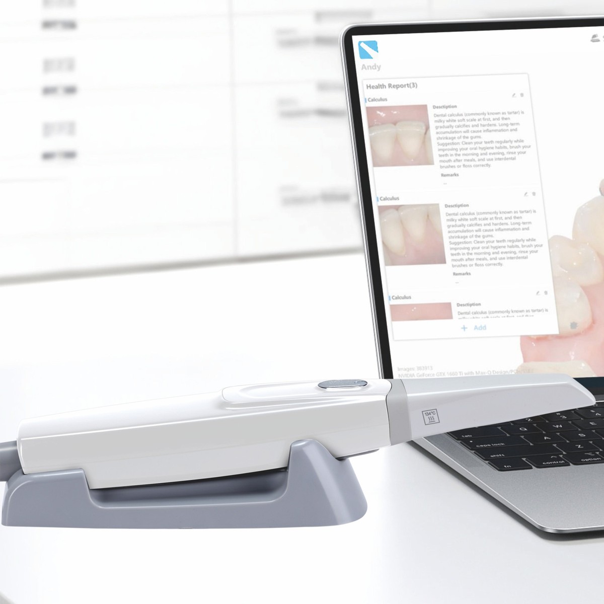 dental scanner price