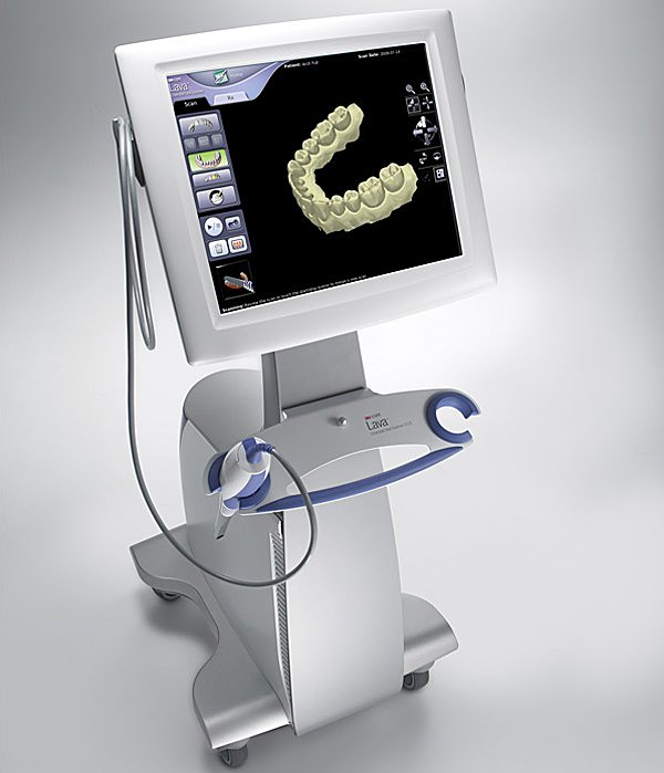 dental scanning equipment