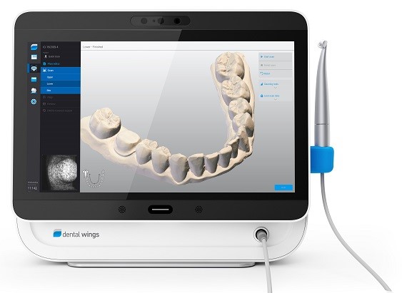 dental wings intraoral scanner digital dentistry