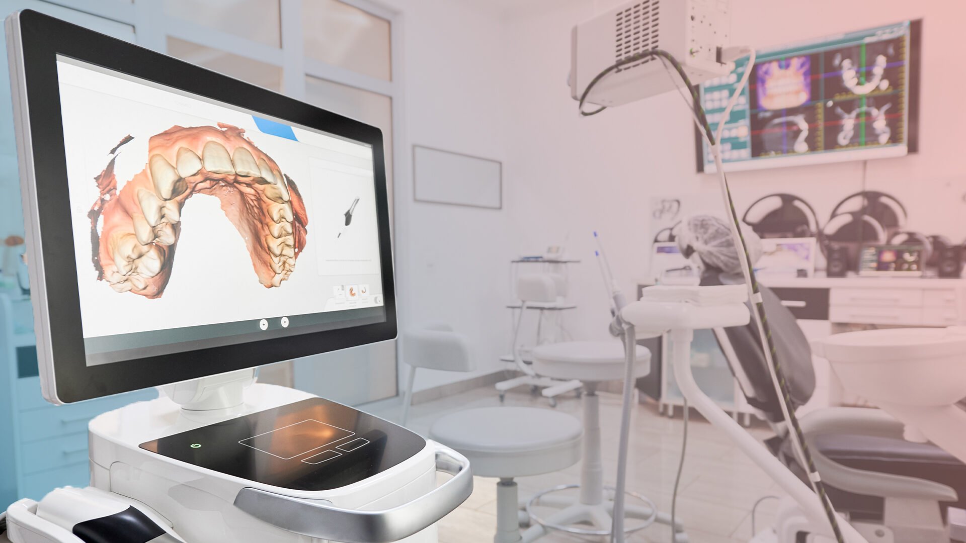 digital dental equipment