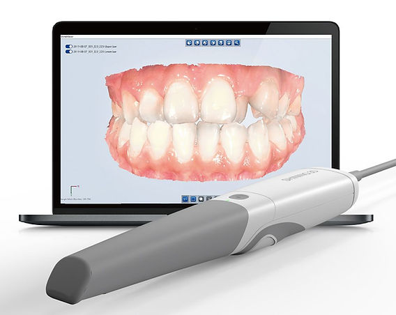digital dental impression scanner
