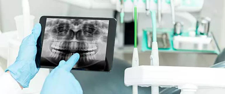 digital dental x ray equipment
