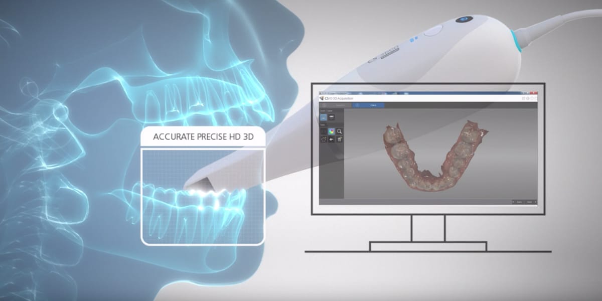 digital impression scanner