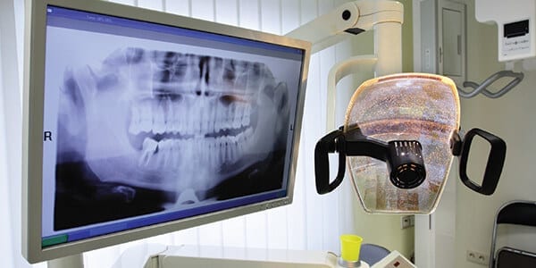 digital opg x ray machine