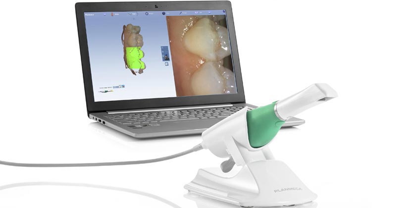 emerald scanner dental