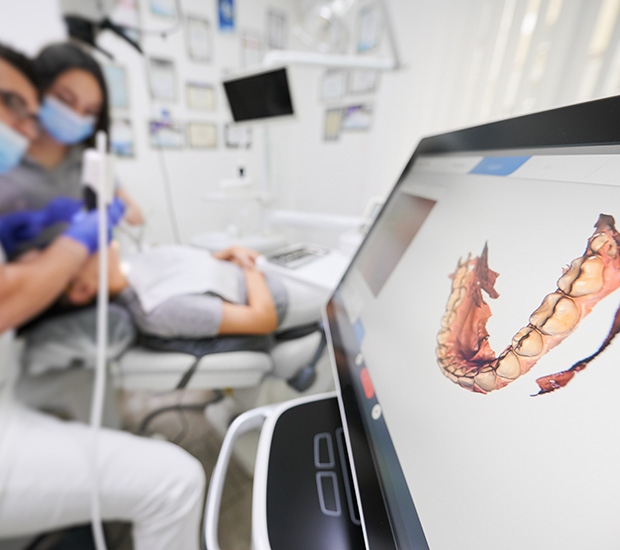 english to hindi camera scanner digital dentistry