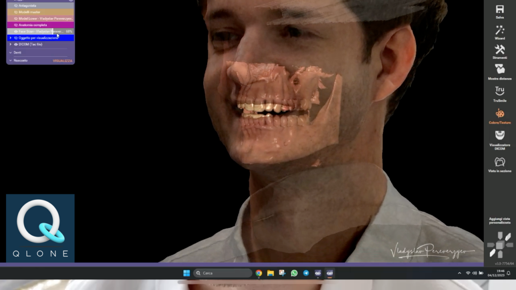 facial 3d scanner
