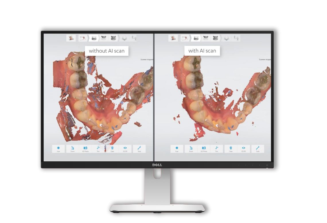 how does scanner work