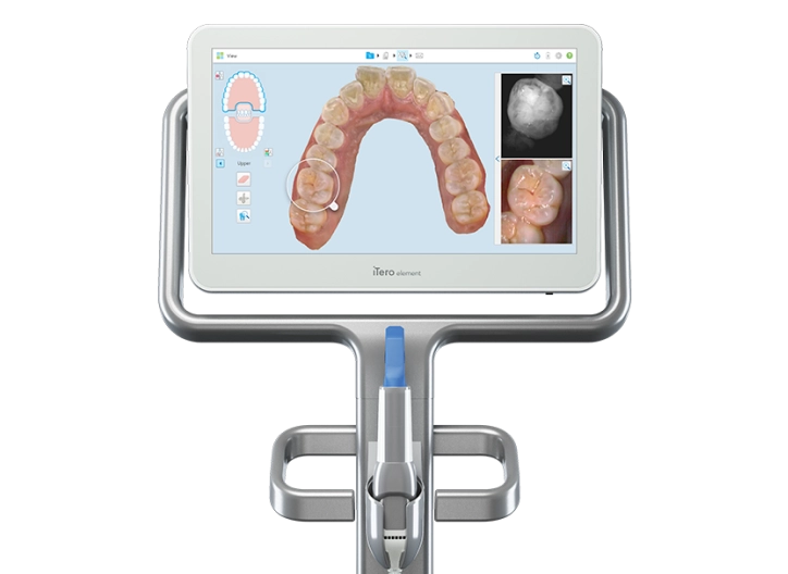 how much does itero scanner cost digital dentistry