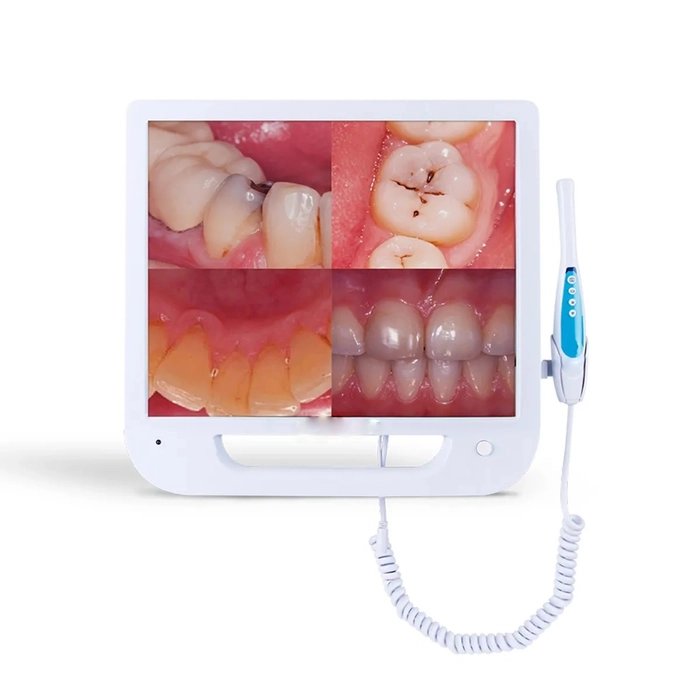 intra oral camera with screen
