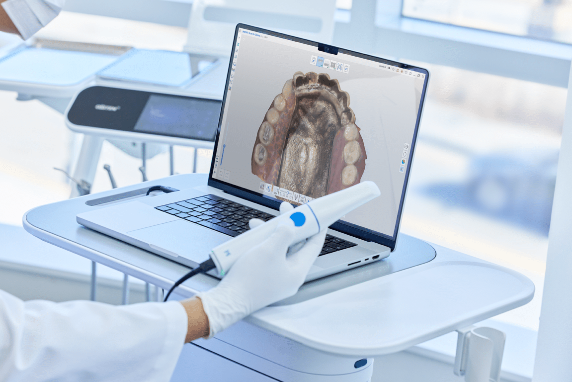 medit intra oral scanner