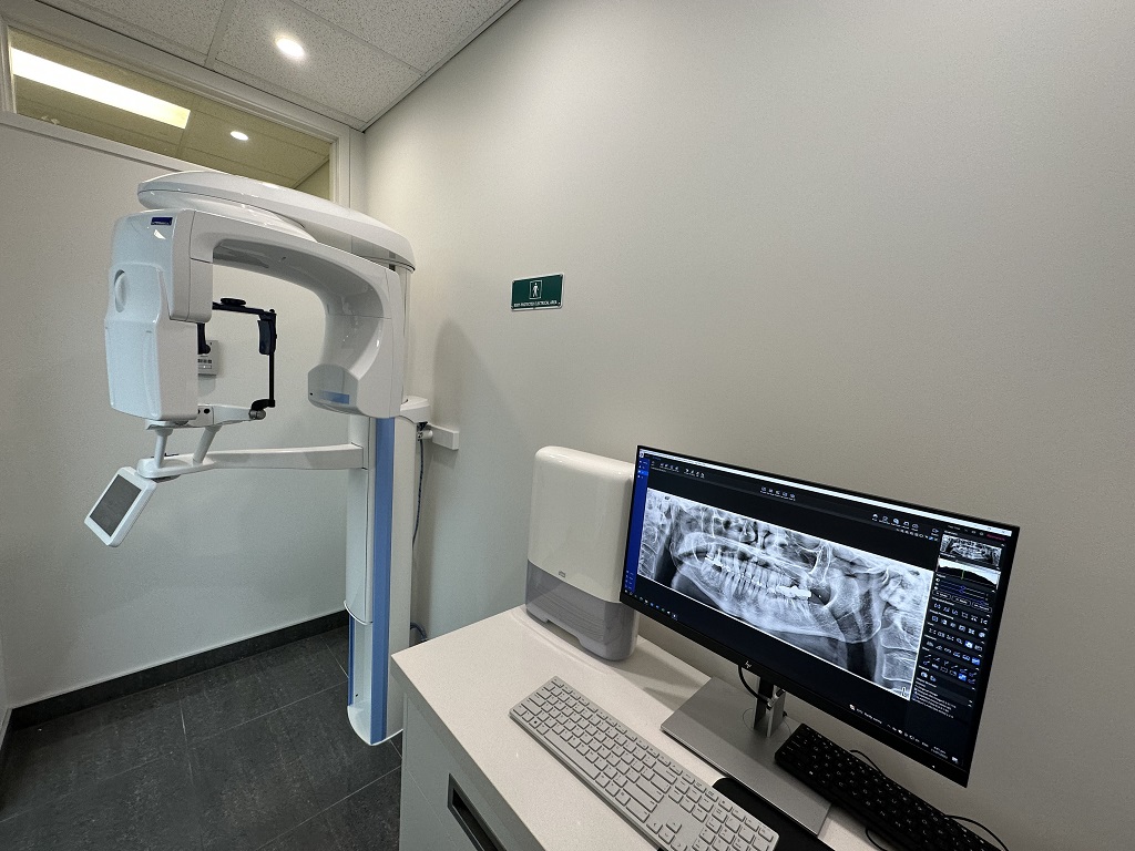 opg cbct machine