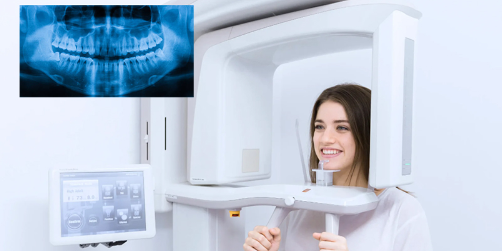opg scan machine digital dentistry