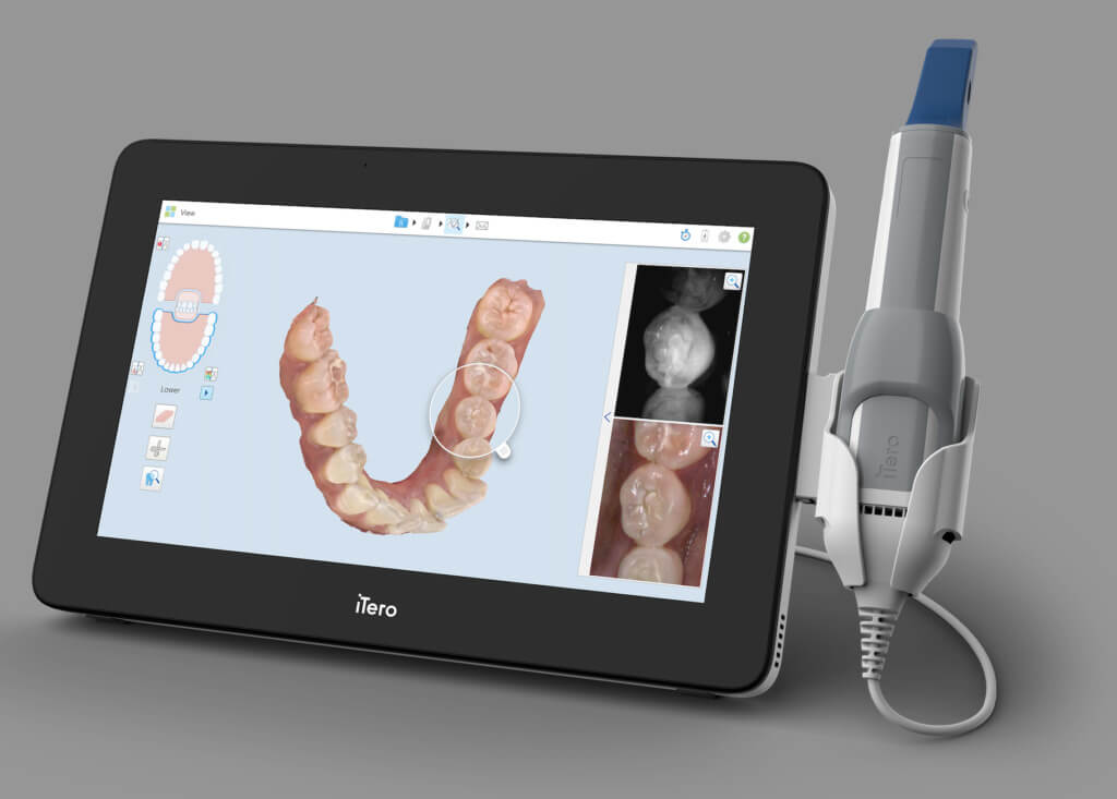 ortho scanner