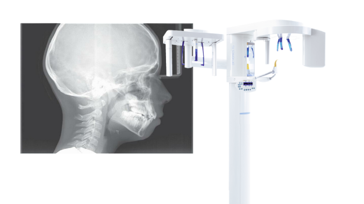 panoramic cephalometric x ray machine digital dentistry