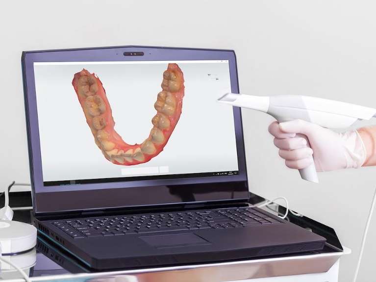 peru indiana scanner