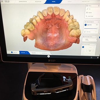 peru indiana scanner