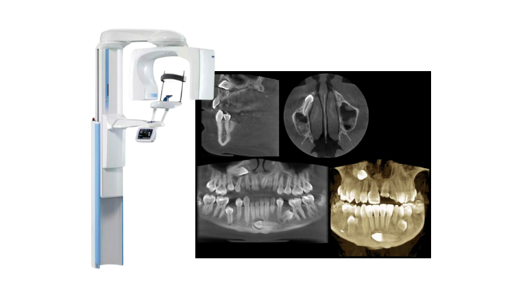 planmeca cbct machine