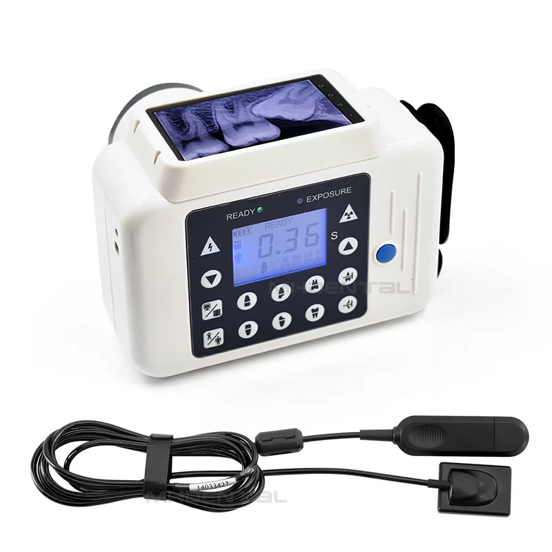 rvg dental x ray machine digital dentistry