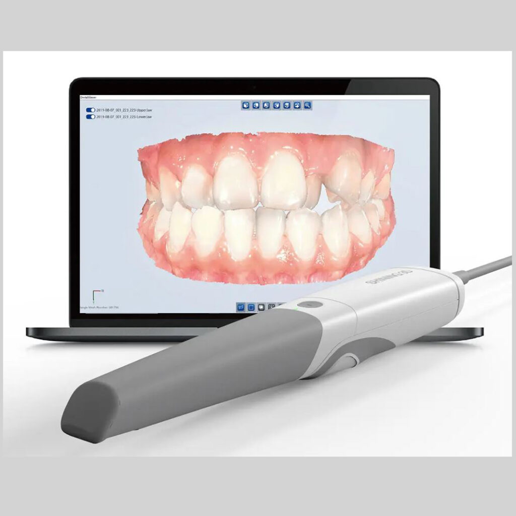 scanner intra buccal digital dentistry