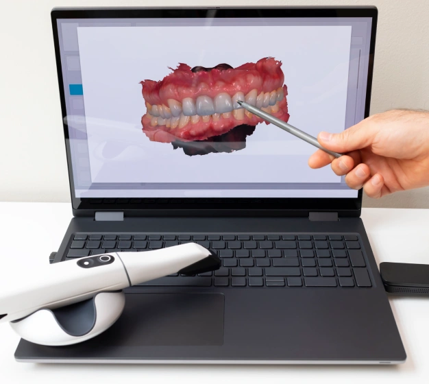 scanner intraoral precio