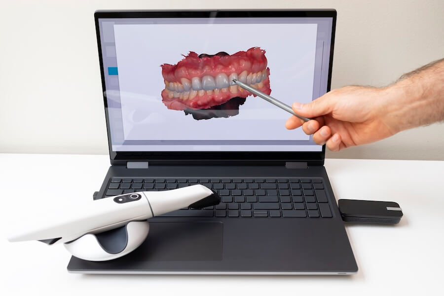 scanners intraorales digital dentistry