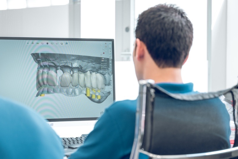 scanners odontologicos