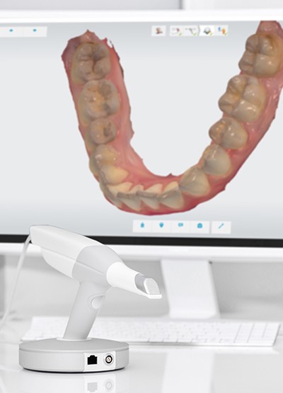 scanners odontologicos