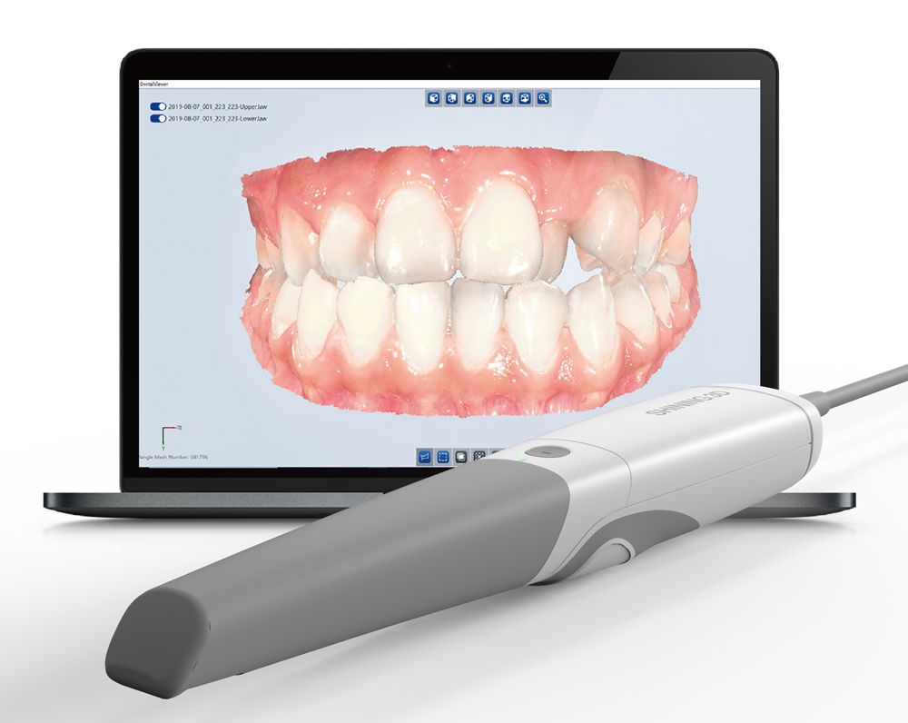 shining 3d intraoral scanner