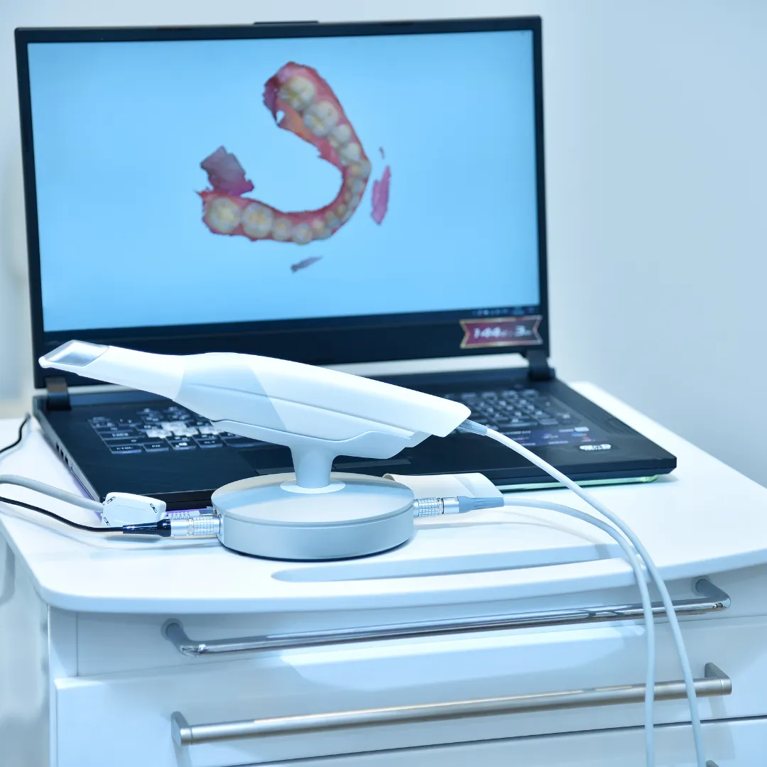 Skanner Eller Scanner Tech Review & Benchmarks 2026