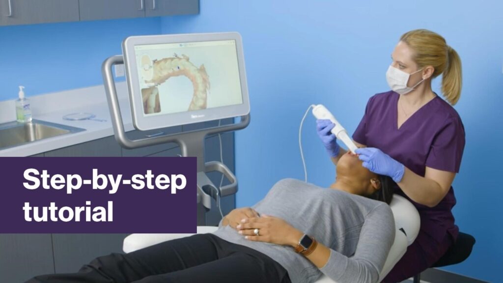 video scanners digital dentistry