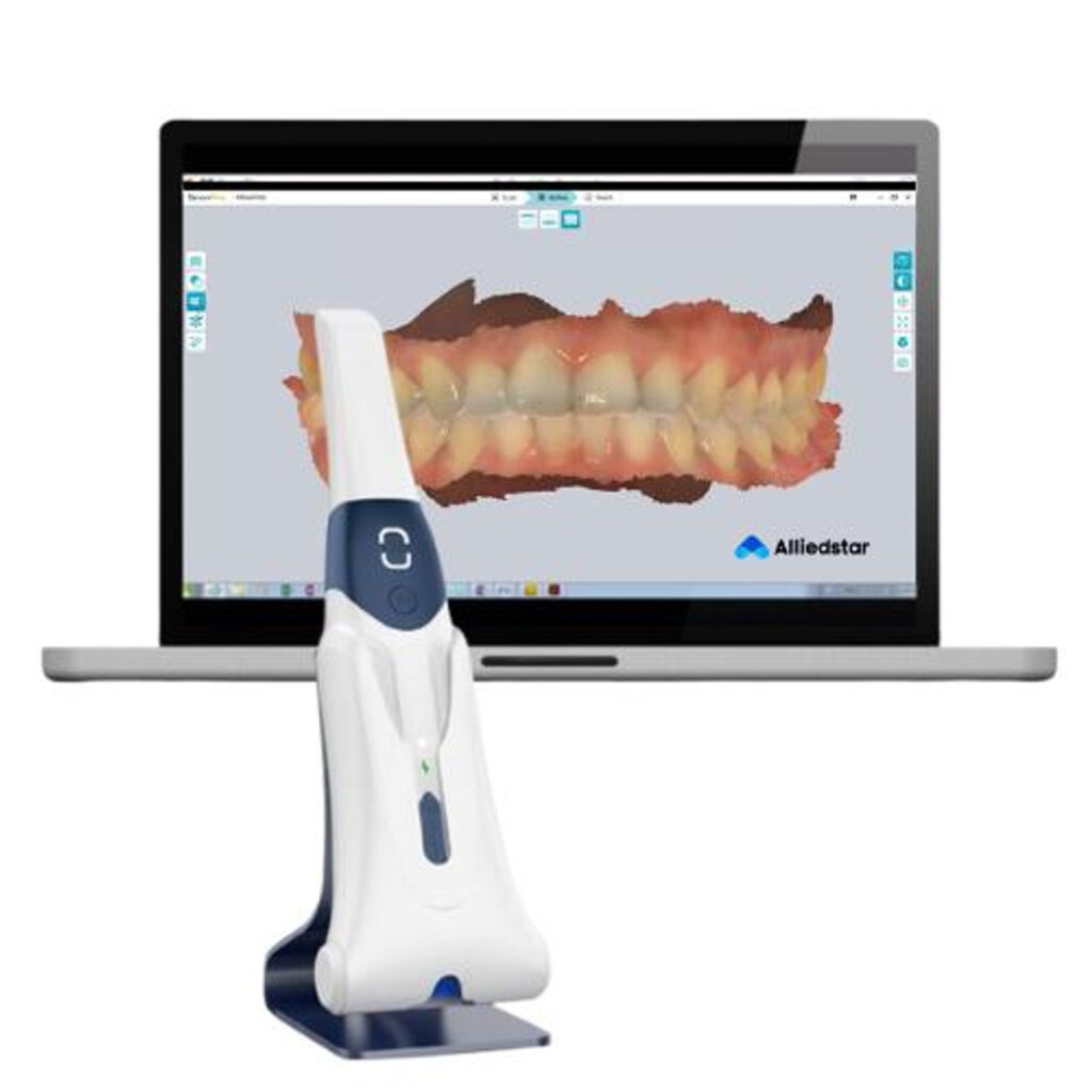 wireless intraoral scanner digital dentistry