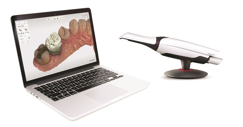 wireless intraoral scanner