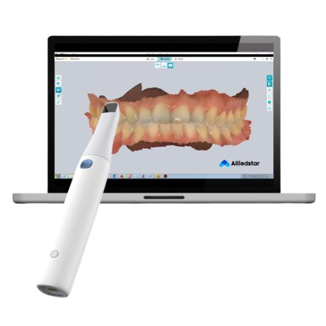 wireless intraoral scanner
